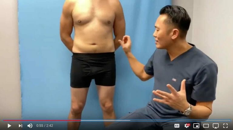 ChestSculpt + Total Sculpt | Grade 2 Gynecomastia 6 ChestSculpt + TotalSculpt | Grade 2 Gynecomastia Surgery and liposuction