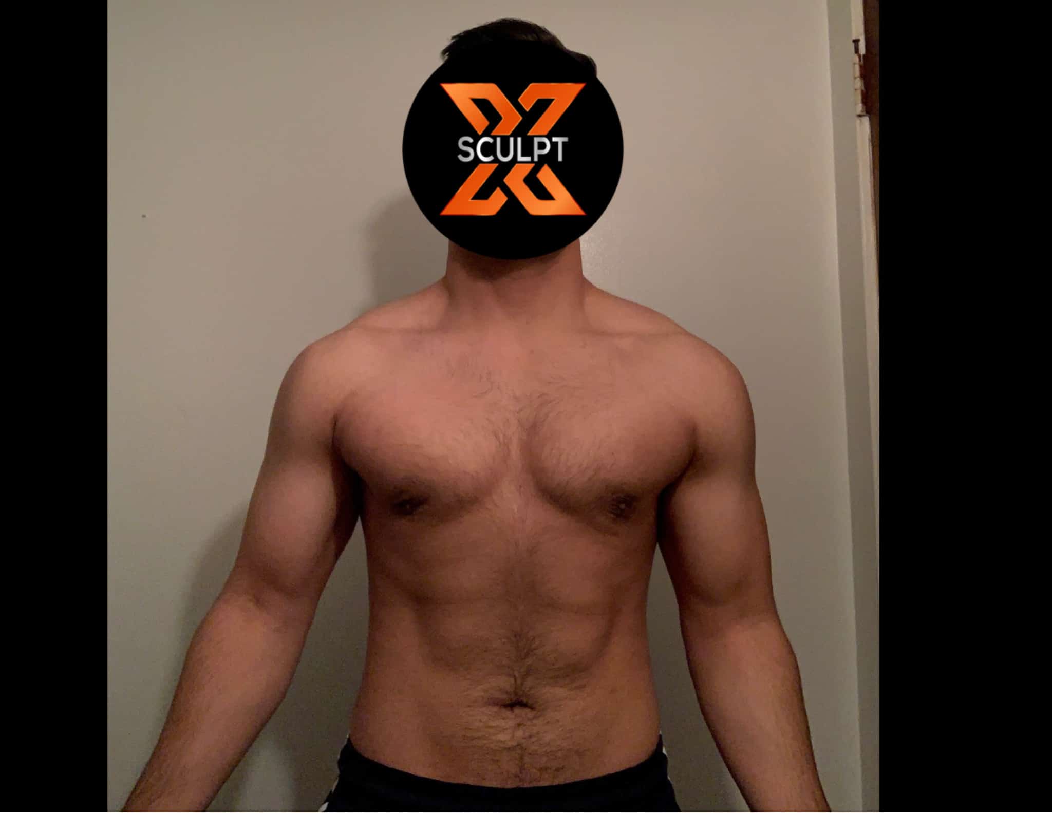 Xsculpt “The best experience from start to finish”
