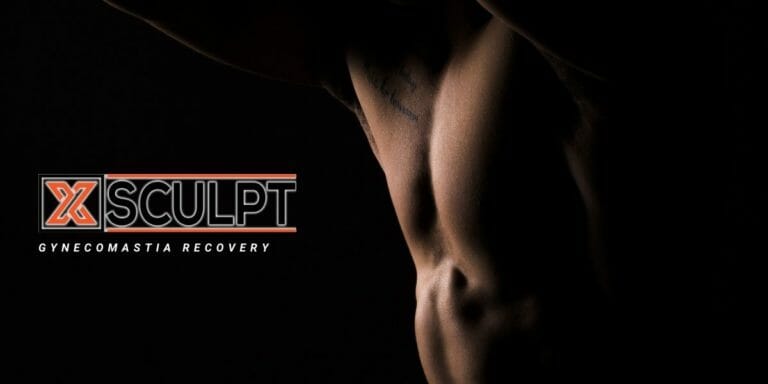 gynecomastia recovery xsculpt