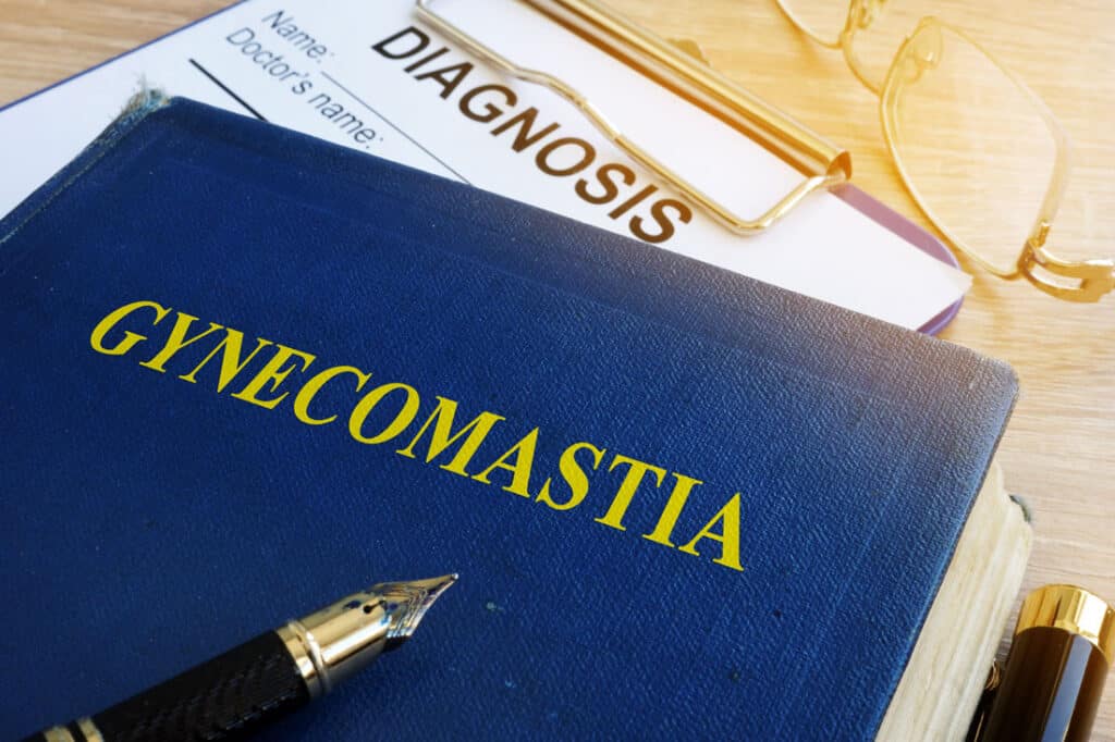 non surgical gynecomastia treatments