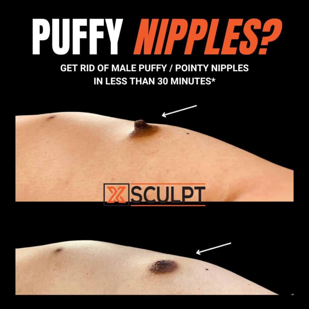 what do puffy nipples look like