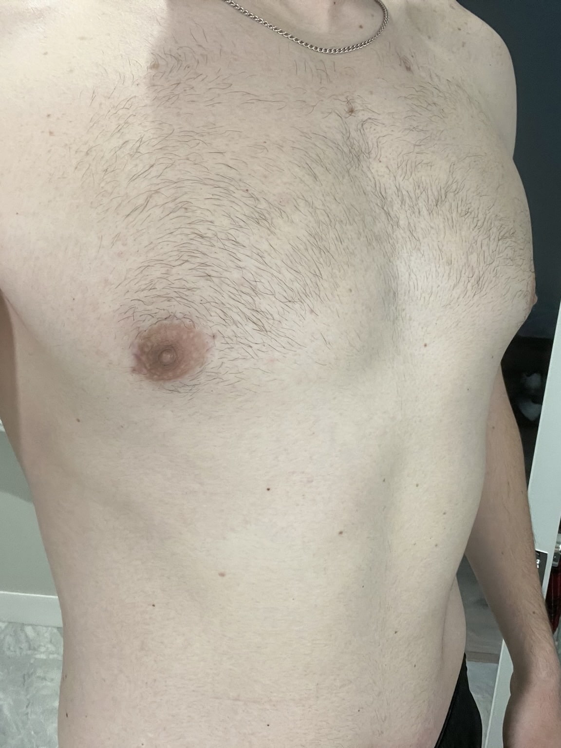 Xsculpt Male Surgery