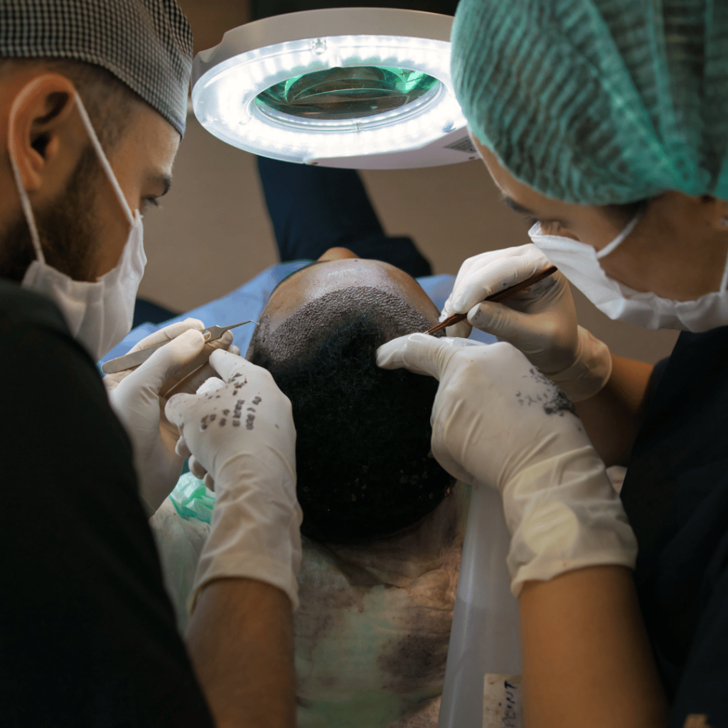 Hair Transplant Cost in Chicago: What to Expect in 2026 1 A group of people performing FUE and FUT hair transplants on a patient's head.