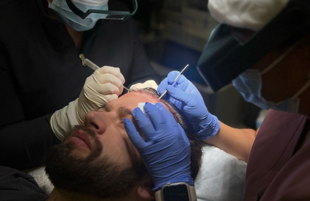In Chicago, a man is getting his hair transplant by a surgeon.000