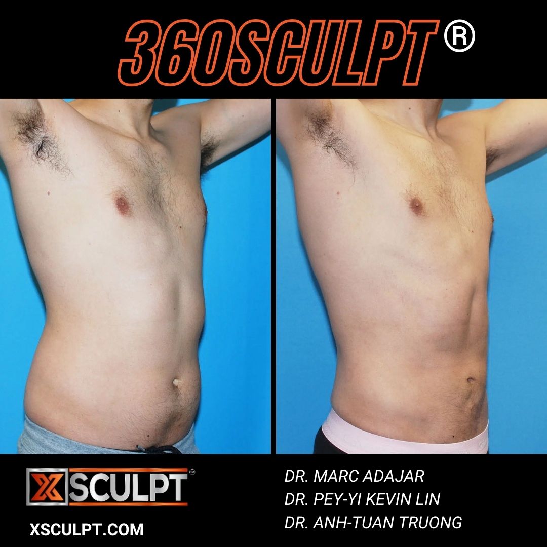360Sculpt