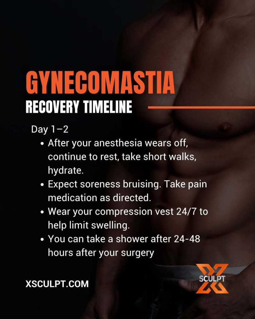 Gynecomastia Surgery Recovery: What To Expect 3 What is gynecomastia recovery like at xsculpt chicago