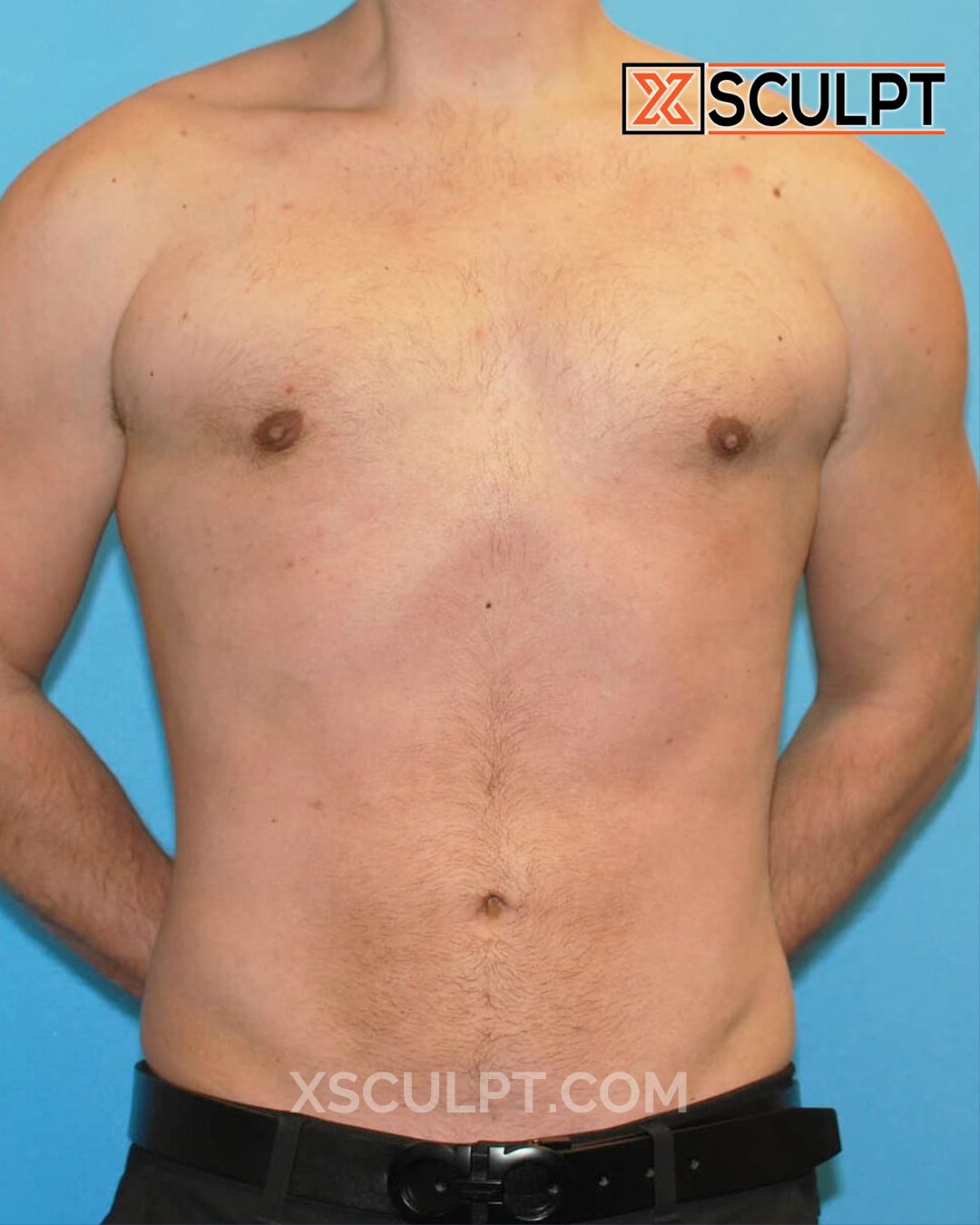 72514153 TotalSculpt Dr. Adajar Chicago 6mos