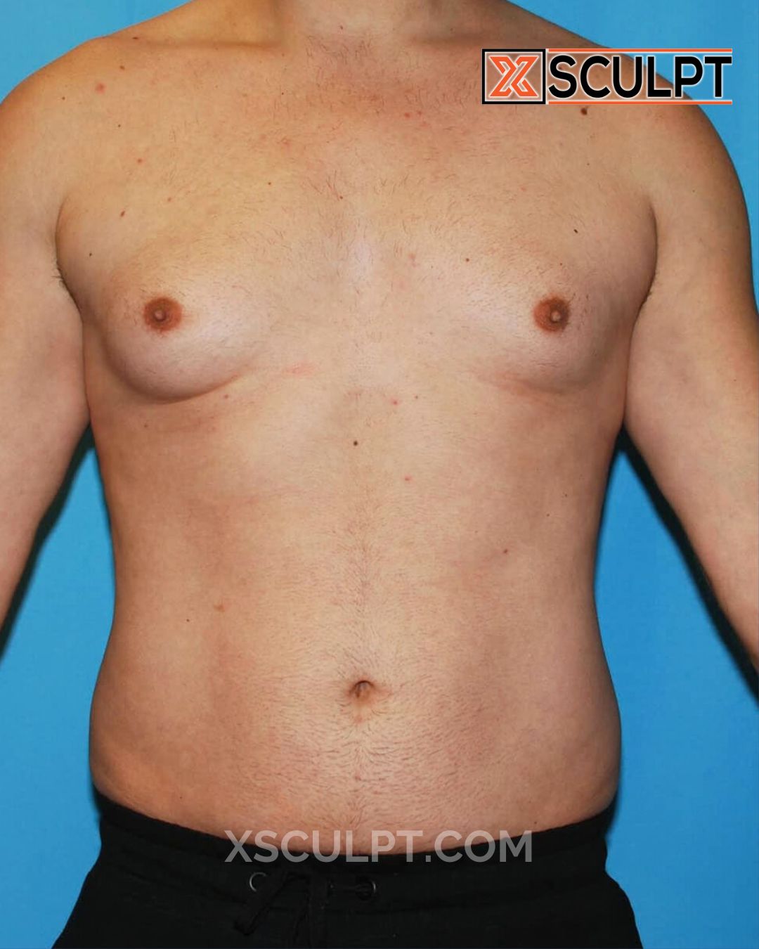 72514153 TotalSculpt Dr. Adajar Chicago 6mos